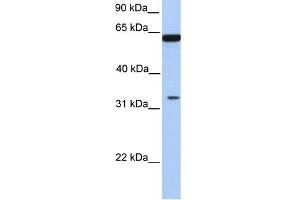 WB Suggested Anti-PERLD1 Antibody Titration:  0. (PGAP3 antibody  (N-Term))