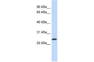 Western Blotting (WB) image for anti-Kruppel-Like Factor 16 (KLF16) antibody (ABIN2457888)