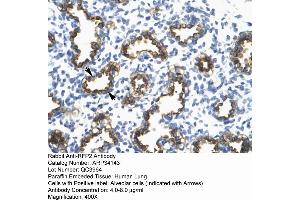 Human Lung (TRIM13 antibody  (Middle Region))