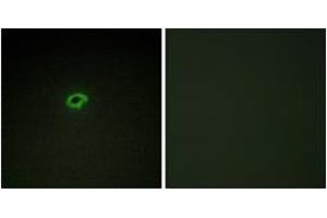 Immunofluorescence analysis of COS7 cells, using Collagen IV alpha4 Antibody. (Col4a4 antibody  (AA 541-590))
