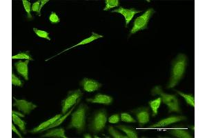 Immunofluorescence of purified MaxPab antibody to HADH on HeLa cell. (HADH antibody  (AA 1-314))
