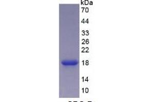 SDS-PAGE of Protein Standard from the Kit  (Highly purified E. (CEA ELISA Kit)