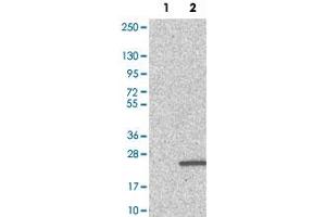 Western Blot analysis of Lane 1: negative control (vector only transfected HEK293T cell lysate) and Lane 2: over-expression lysate (co-expressed with a C-terminal myc-DDK tag in mammalian HEK293T cells) with PFDN4 polyclonal antibody .