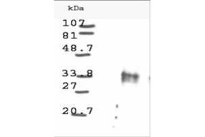 Image no. 1 for anti-Cyclin D1 (CCND1) antibody (ABIN221149) (Cyclin D1 antibody)