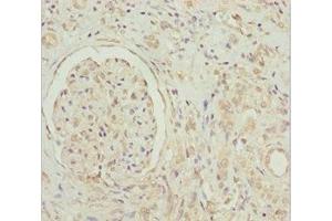 Immunohistochemistry of paraffin-embedded human kidney tissue using ABIN7154750 at dilution of 1:100 (GNB1L antibody  (AA 1-327))