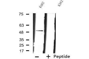 Western blot analysis of extracts from K562 cells using LPCAT2 antibody. (LPCAT2 antibody  (N-Term))