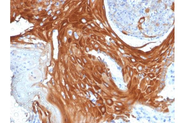 KRT6A antibody