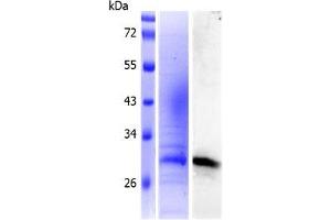 Western Blotting (WB) image for Ephrin B1 (EFNB1) (AA 28-237) protein (His tag) (ABIN3092285)