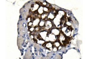 IHC analysis of SYP using anti-SYP antibody (ABIN7603120).