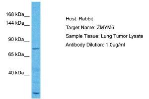 Host: Rabbit Target Name: ZMYM6 Sample Type: Lung Tumor lysates Antibody Dilution: 1.