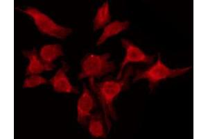ABIN6274577 staining A549 by IF/ICC. (Serotonin Receptor 6 antibody  (Internal Region))