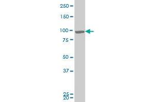 RIPK4 monoclonal antibody (M04), clone 4H5 Western Blot analysis of RIPK4 expression in A-431 . (RIPK4 antibody  (AA 675-784))