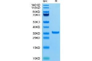 SARS-CoV-2 3CLpro (A191V) on Tris-Bis PAGE under reduced condition. (SARS-Coronavirus Nonstructural Protein 8 (SARS-CoV NSP8) (A191V) Protein)