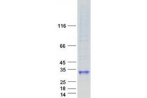 Validation with Western Blot