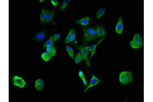 Immunofluorescence staining of MCF-7 cells with ABIN7142970 at 1:100, counter-stained with DAPI. (Acetylcholinesterase antibody  (AA 53-162))