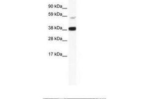 Image no. 1 for anti-V-Rel Reticuloendotheliosis Viral Oncogene Homolog B (RELB) (AA 358-407) antibody (ABIN202760) (RELB antibody  (AA 358-407))