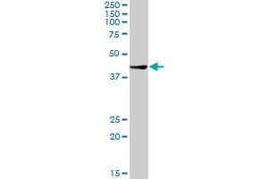 CTBS MaxPab rabbit polyclonal antibody. (CTBS antibody  (AA 1-385))