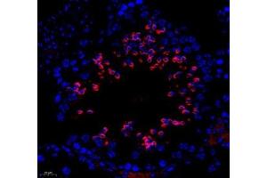 Immunofluorescence of paraffin embedded mouse testis using ESD (ABIN7073862) at dilution of 1: 400 (250x lens) (Esterase D antibody)