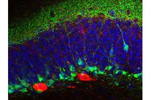 Indirect immunostaining of a mouse hippocampus section with anti-parvalbumin (dilution 1 : 500; red) and rabbit anti-calretinin (, dilution 1 : 500; green).
