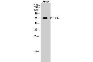 Western Blotting (WB) image for anti-PFK-2 LIV (C-Term) antibody (ABIN3176850) (PFK-2 LIV (C-Term) antibody)