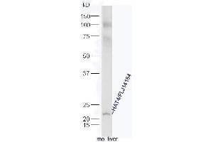 Mouse liver lysate probed with Rabbit Anti-HAT4 Polyclonal Antibody, Unconjugated (ABIN2559490) at 1:300 in 4˚C. (NAT15 antibody  (AA 1-100))