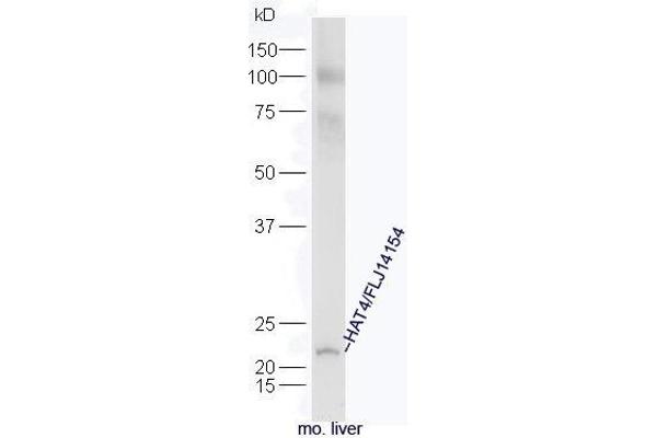 NAT15 antibody  (AA 1-100)