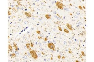 Immunohistochemistry analysis of paraffin-embedded rat brain using MBP Polyclonal Antibody at dilution of 1:500. (MBP antibody)