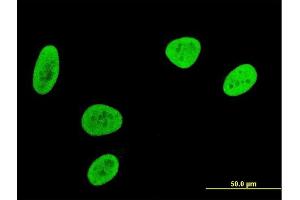 Immunofluorescence of monoclonal antibody to MEF2BNB on HeLa cell .