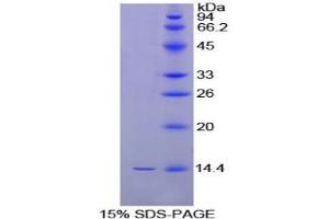 SDS-PAGE analysis of Chicken Inhibin beta B Protein. (INHBB Protein)