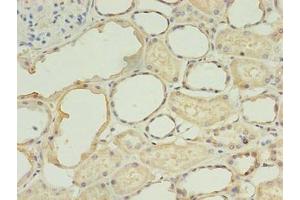 Immunohistochemistry of paraffin-embedded human kidney tissue using ABIN7173390 at dilution of 1:100 (TGS1 antibody  (AA 713-853))