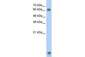 Western Blotting (WB) image for anti-Methyl-CpG Binding Domain Protein 1 (MBD1) antibody (ABIN2460355) (MBD1 antibody)