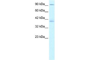 WB Suggested Anti-KIFC2 Antibody Titration:  1. (KIFC2 antibody  (N-Term))