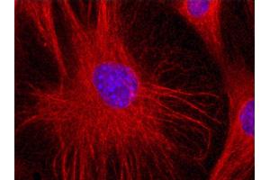 Immunofluorescence staining (mouse fibroblasts) Immunofluorescence staining of 3T3 mouse embryonal fibroblast cell line with anti-Vimentin (VI-01) Dyomics 547. (Vimentin antibody)