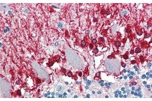Detection of ALDH1A3 in Human Cerebellum Tissue using Polyclonal Antibody to Aldehyde Dehydrogenase 1 Family, Member A3 (ALDH1A3) (ALDH1A3 antibody  (AA 332-509))