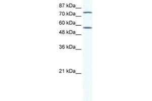 Western Blotting (WB) image for anti-Interferon Regulatory Factor 4 (IRF4) antibody (ABIN2460532) (IRF4 antibody)