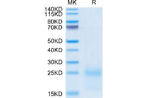 SDS-PAGE (SDS) image for Thymic Stromal Lymphopoietin (TSLP) (AA 29-159) protein (His tag) (ABIN7275799)
