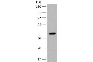 Western blot analysis of Human placenta tissue lysate using FCGRT Polyclonal Antibody at dilution of 1:400 (FcRn antibody)
