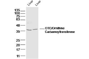 Lane 1: mouse iver lysates Lane 2: rat liver lysates probed with OTC/Ornithine Carbamoyltransferase Polyclonal Antibody, Unconjugated  at 1:300 dilution and 4˚C overnight incubation. (OTC antibody  (AA 31-130))