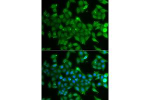 Immunofluorescence analysis of A549 cells using ANXA11 antibody. (Annexin A11 antibody)