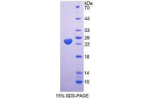 SDS-PAGE (SDS) image for Spermidine/spermine N1-Acetyltransferase 1 (SAT1) (AA 1-171) protein (His tag) (ABIN6237512) (SAT1 Protein (AA 1-171) (His tag))