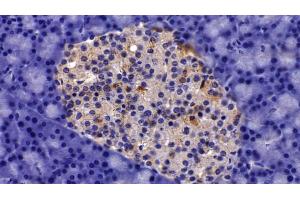 Detection of AST2 in Rat Pancreas Tissue using Polyclonal Antibody to Aspartate Aminotransferase 2 (AST2) (AST2 (AA 30-430) antibody)