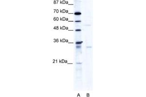 Western Blotting (WB) image for anti-TRIM17 / RNF16 (TRIM17) antibody (ABIN2460982) (TRIM17 / RNF16 antibody)