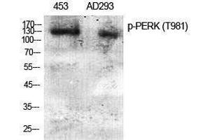Western Blotting (WB) image for anti-Eukaryotic Translation Initiation Factor 2-alpha Kinase 3 (EIF2AK3) (pThr981) antibody (ABIN3179812) (PERK antibody  (pThr981))