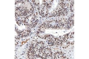 IHC analysis of SNRNP40 using anti-SNRNP40 antibody (ABIN7601719).