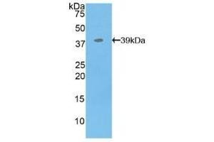 Detection of Recombinant MBP, Human using Polyclonal Antibody to Myelin Basic Protein (MBP) (MBP antibody  (AA 220-301))