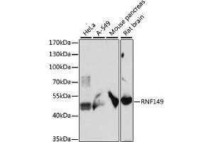 Western blot analysis of extracts of various cell lines, using RNF149 antibody (ABIN7270062) at 1:1000 dilution. (RNF149 antibody  (AA 221-400))