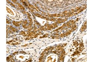 ABIN7094345 and ABIN7098392 at 1/100 staining Rat ovary tissue by IHC-P.