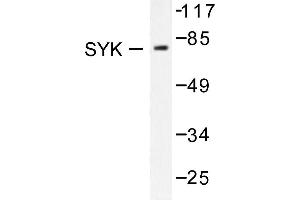 Image no. 1 for anti-Spleen tyrosine Kinase (SYK) antibody (ABIN271835) (SYK antibody)