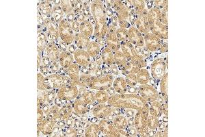 Immunohistochemistry of paraffin embedded mouse kidney using AZI2 (ABIN7072856) at dilution of 1:650 (300x lens) (AZI2 antibody)