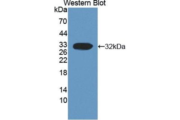 Calpain 3 antibody  (AA 602-821)